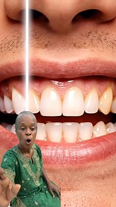 2.1K views · 137K reactions | Comment your age if you’re from the US  #soursop #guthealth #us #usahealth #womenshealth | Vanessa.Healthtips | Facebook