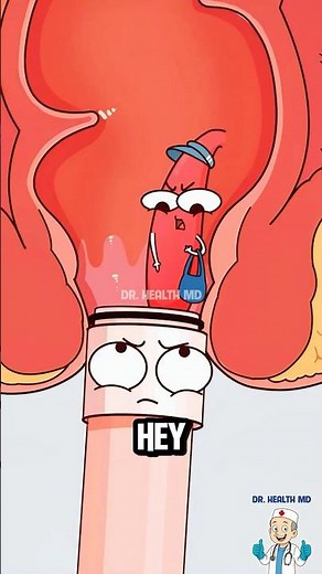 This Is How Doctors Treat Hemorrhoids! 🤯 #hemorrhoids #shorts