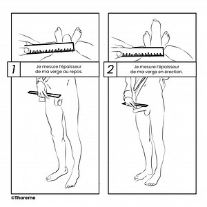 L'anneau Andro-switch - Contraception masculine thermique - THOREME