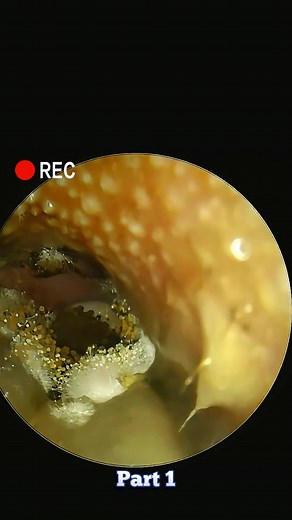 Pretty Ear 2024 on TikTok