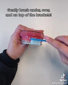 Barbieri Ortho presents the ultimate brushing guide during treatment ✨ #oralhygiene #cleanteeth #barbieriortho #bracescaretips | Barbieri Orthodontics | Facebook