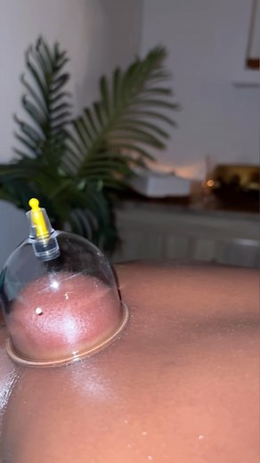 🔮Cupping Therapy (Hijama in Arabic) is an ancient, traditional & Holistic Method that has been used for thousands of years to treat a wide range of common medical issues. Cupping Therapy helps Relieve common chronic pain disorders. Promote mobility and range of motion. Improves mature scars. Decrease TOXINS.🦠🦠 ((As we all know, toxins in your blood damage your enzymes, which can accelerate aging. It also can lead to the failure of energy production and lower your protection against oxidated s