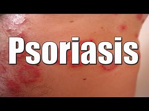 Psoriasis and Penis Care: What Men Must Know