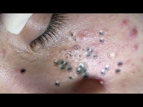 𝑁𝑒𝑤 𝐻𝑜𝑝𝑒 𝐹𝑟𝑜𝑚 𝑉𝑖𝑑𝑒𝑜 𝐿𝑢𝑥𝑢𝑟𝑦 # 222433