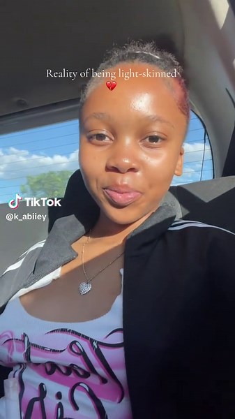 Understanding the Reality of Being Light-Skinned