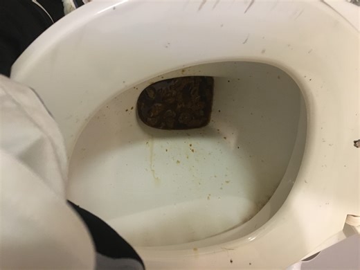 I got diarrhea came back from jogging