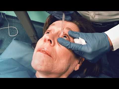 Treatment of a mild tear duct obstruction with local anesthesia