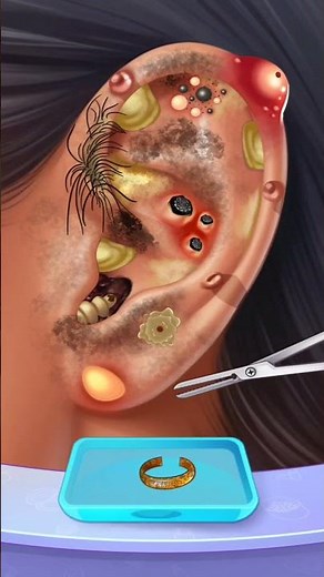 ASMR Ear Cleaning Animation 👂✨ Deep Relaxation & Sleep Aid