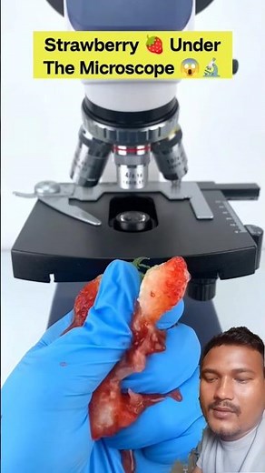 Strawberry 🍓 Under the microscope