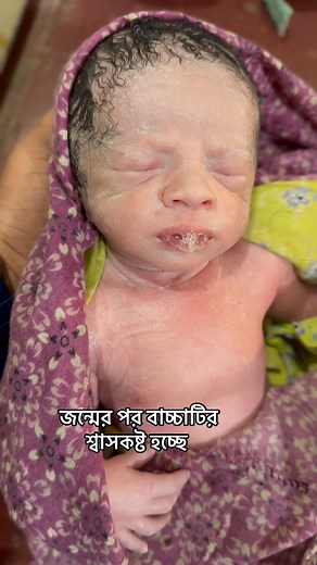 Breathing difficulties newborn #breathing #poorbaby | Dr. Ataur Rahman