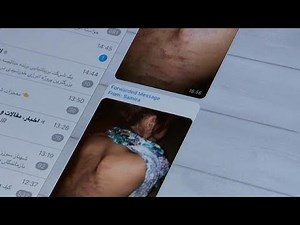 Norway under fire for deporting woman who was whipped in Iran