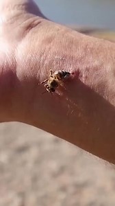 When honey bee stings a human Doctor of physical therapy | Doctor of physical therapy