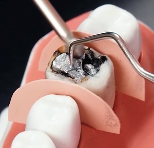 1.2M views · 4.5K reactions | ¿Cómo te arreglan los dentistas los dientes? La magia detrás de los procedimientos dentales | En modo Madera | Facebook