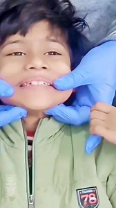 394K views · 2.5K reactions | “Daily Oral Motor Massage Brought...