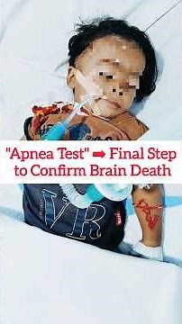 Apnea test - the final step in confirming brain death #apneatest #neurology #medicine #neetpg #fmge