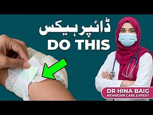 Diaper Tips & Tricks Every New Parent Must Know | Dr Hina Baig