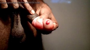 PENIS PUMP ACCIDENT b. BUBBLE.OVERPUMPING SAFETY PRECAUTIONS ADVISED