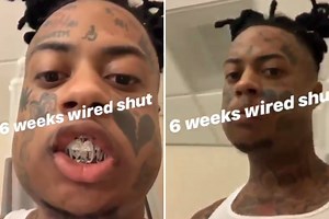Rapper Boonk Gang reveals agony of having his jaw wired shut and moans he can’t lick his lips after he was battered in prank gone wrong