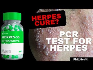 PCR Test for Herpes: The Most Accurate Diagnosis Method