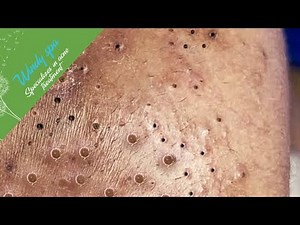 Make Your Day Relaxing with Windy Spa 6#155