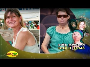 மனிதக் குரங்கால் தாக்கப்பட்டு முகத்தை இழந்து, மீண்டு வந்த பெண் | Chimpanzee Attacked Woman