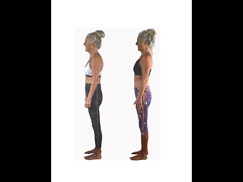 Fix Hip Labrum Tear without Surgery