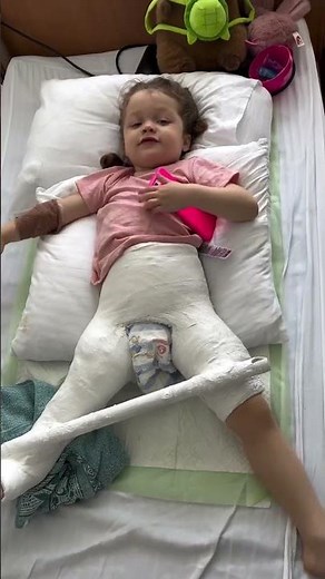 From diagnosis to progress ✨ Watch the journey of DDH plaster treatment step by step. 🦴👶 #DDHcare"