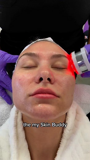 💜 The My Skin Buddy Boost is a multifunctional skincare device that combines advanced technologies like ultrasonic waves and LED light therapy to enhance skin health, improve absorption of products, and promote a radiant complexion. 💜20% off this month for Club Fizz Members 🤗☎️ 501.504.6882🖥️ fizzfacialbar.com📱 Schedule on our app!#skincaretothepoint #ffb #fizzfacialbar #favoritefaceplace #esthetician #arkansasesthetician #skingoals #fizzfacialbarconway | Fizz Facial Bar Conway