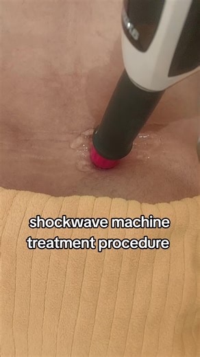 ‏electric shockwave treatment for lower back pain,