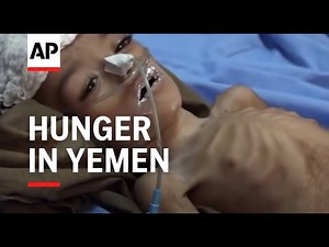 Children in rural areas dying from malnutrition