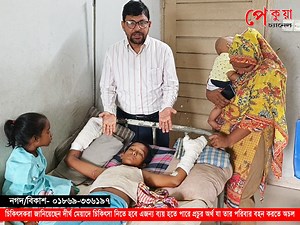 2.8M views · 3.1K reactions | বিদ্যুৎস্পৃষ্টে দুই হাত দ'গ্ধ হয়ে জীবন...