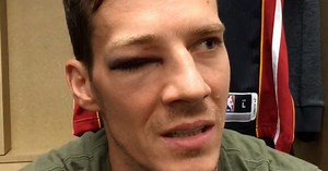 The story behind Dragic’s eye injury!