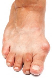 Can Exercises Fix Bunions, Hammertoes, or Flat Feet? Dr. John Hoy Explains
