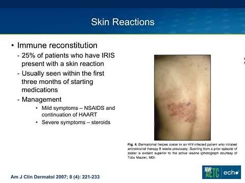 Acute Side Effects from Antiretroviral Medication