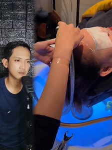 Asmr klinik #react #asmr #amazing #fypage #trending | Elga Sarwindi