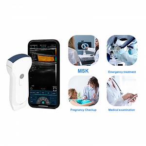 [Hot Item] Portable Ultrasound Scanner Ultrasonic Portable Wireless Ultrasound Scanner for primary care and POCUS linear convex phased array probe of color doppler