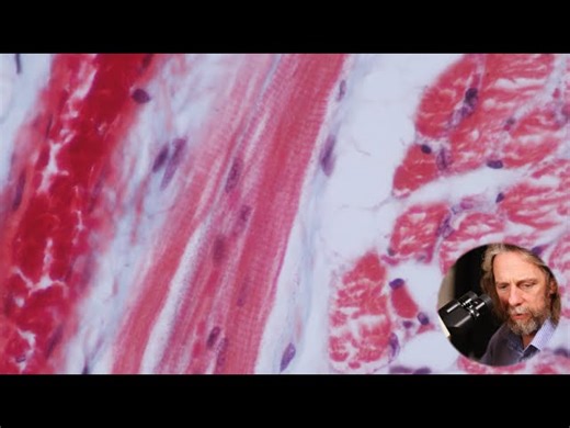 Our Body - Microscopic Examination Of Muscles - Tongue Muscle