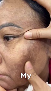 Still think age spots come from too much ☀️? Féline Skinscience exposes the TRUE cause and solution! ✅ Fades acne marks, age spots, melasma ✅ Clinically proven, dermatologist-recommended ✅ No Makeup ✅ No Prescriptions ✅ No Expensive Treatments Most women are using the wrong approach. That’s why spots keep coming back—even after endless creams and serums. Féline’s Dark Spot Corrector targets the real cause, working deep in the skin for visible, lasting results. Illuminate Your Skin Now! 🔽 https: