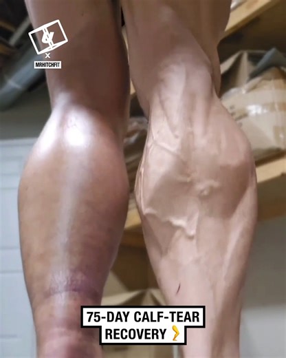 Blood, sweat & tears went into this amazing recovery 🦵😮 | UNILAD