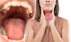 Mouth cancer: What are the causes and symptoms?