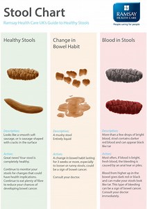 Why does my poop smell like fish and eggs? [2025] | QAQooking.wiki