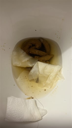 1/21/26 - IBS Flare Log Explosion