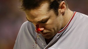 Angels’ Cowgill on DL with broken nose, thumb