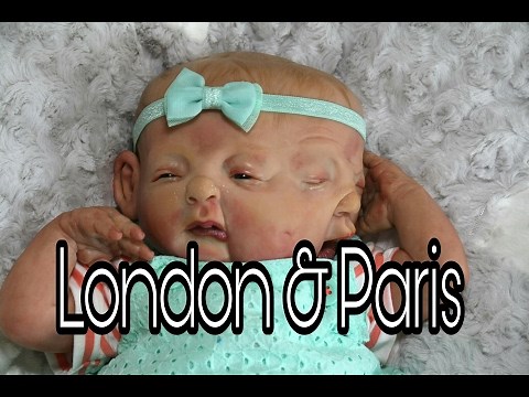 Conjoined Twin Girls! Two Faced Baby! Baby Born With Two Faces One Body! nlovewithreborn2011