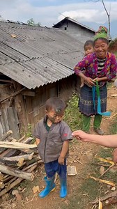 1.3M views · 24K reactions | Thương cho cháu vừa mí chơ, không may bị úp mặt vào bếp nửa, bỏng gia đình không cho con đi chữa để cháu bị như vậy quá thương cháu. | Phạm Tiến Đông | Facebook