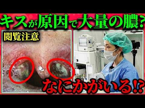 [Massive Amounts of Pus] Excruciating Throat Pain… Could the Real Cause Be a "Kiss"!? [Cold vs. T...