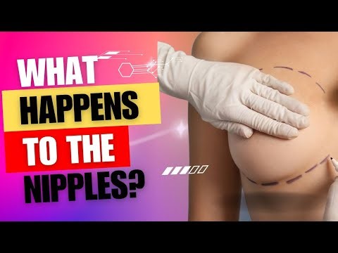 What Happens to your Nipples in Breast Explant and lift Surgery with Doctor Whitfield]