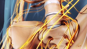 The vast majority of sciatica symptoms result from lower back disorders between the L4 and S1 levels, which put pressure on or cause irritation to a lumbar nerve root. Learn more: http://bit.ly/1NAkBFG | Spine-health