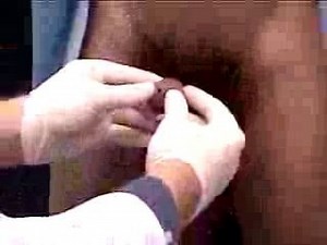 Male Genitals And Rectum Examination Part 3 Sissy Anal