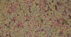 Pituitary Gland Cross Section Under Microscope Stock Footage Video (100% Royalty-free) 3675979043 | Shutterstock